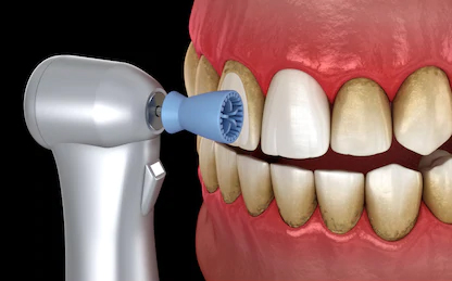 best dental clinic in Surat